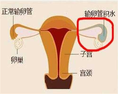 北京中国助孕机构_孕晚期可以拍孕妇照吗