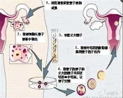 北京最好的助孕机构_孕二十六周肚子有多大