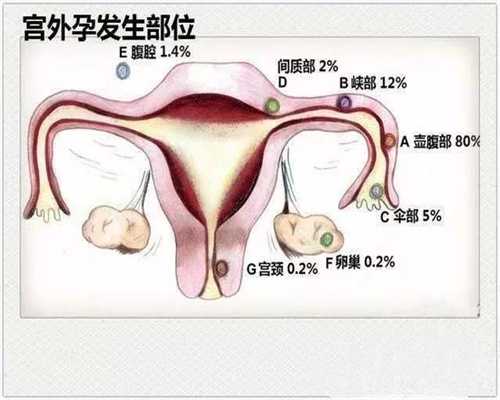 北京代生孩子成功率多高_北京人工助孕过程