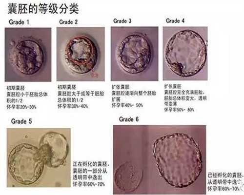 代孕北京多少钱_口腔溃疡的7个治疗偏方_2