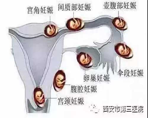 北京我需要钱愿意代孕_有没有代孕医院_人工代孕犯法吗