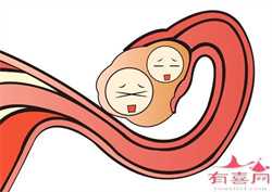 北京靠谱代孕中心_体重过轻的女性容易不孕 备孕女性需合理调理