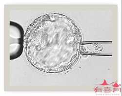 北京如何代孕~北京哪里有针灸代孕~北京代生孩子公司排名