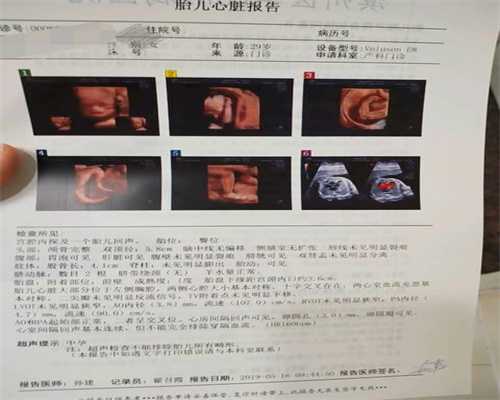 北京哪家医院能代孕-试管供卵中介骗局_如何提高卵子质量 北京试管婴儿医院哪