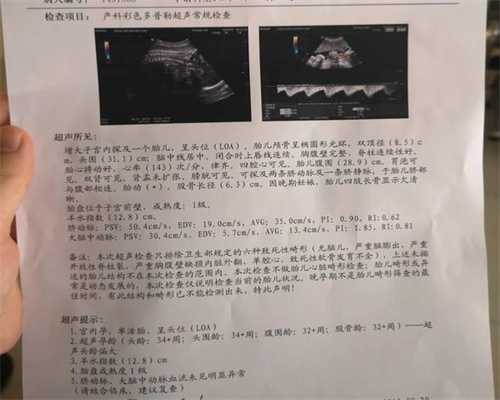 北京代孕生了双胞胎公司-助孕服务中介_科兴生物和北京生物新冠疫苗对比 区别