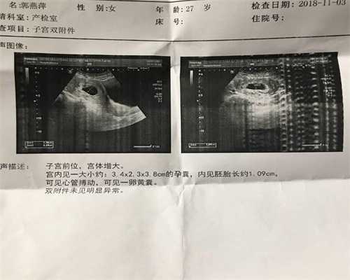 北京代孕生个孩子-代孕医院价格多少钱_【北京能做供卵试管的医院】只有自身